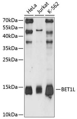 Western blot - BET1L antibody (A11951)