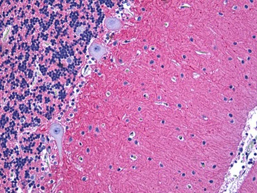 Immunohistochemistry of human cerebellum tissue stained using NCAM1 Monoclonal Antibody.