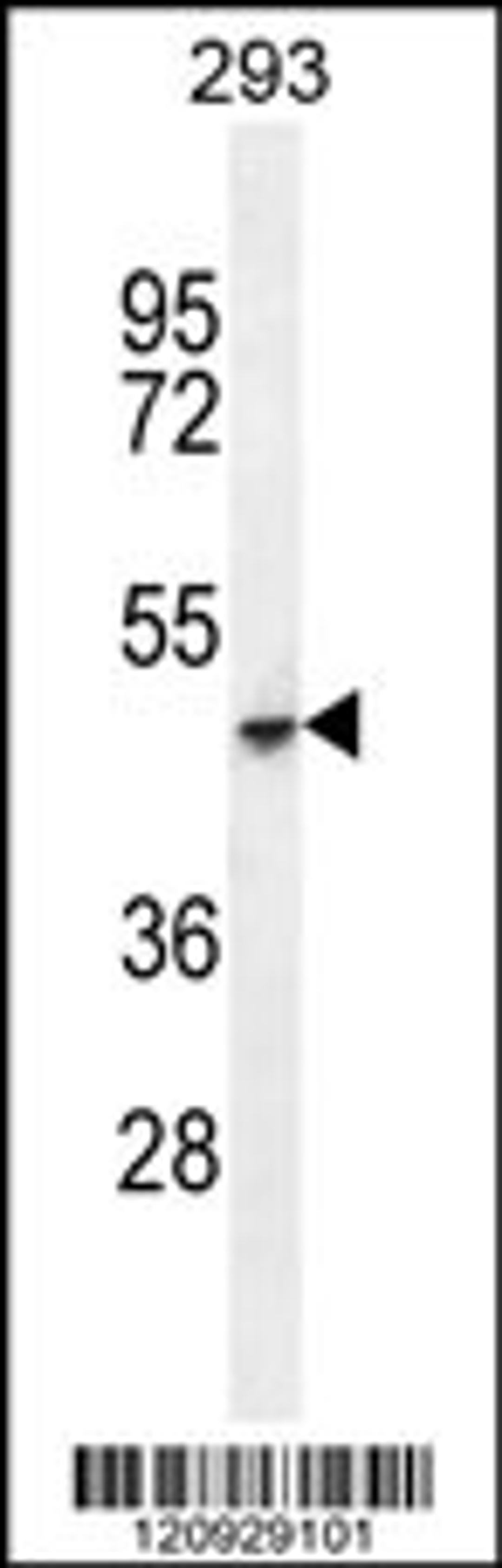 Western blot analysis in 293 cell line lysates (35ug/lane).