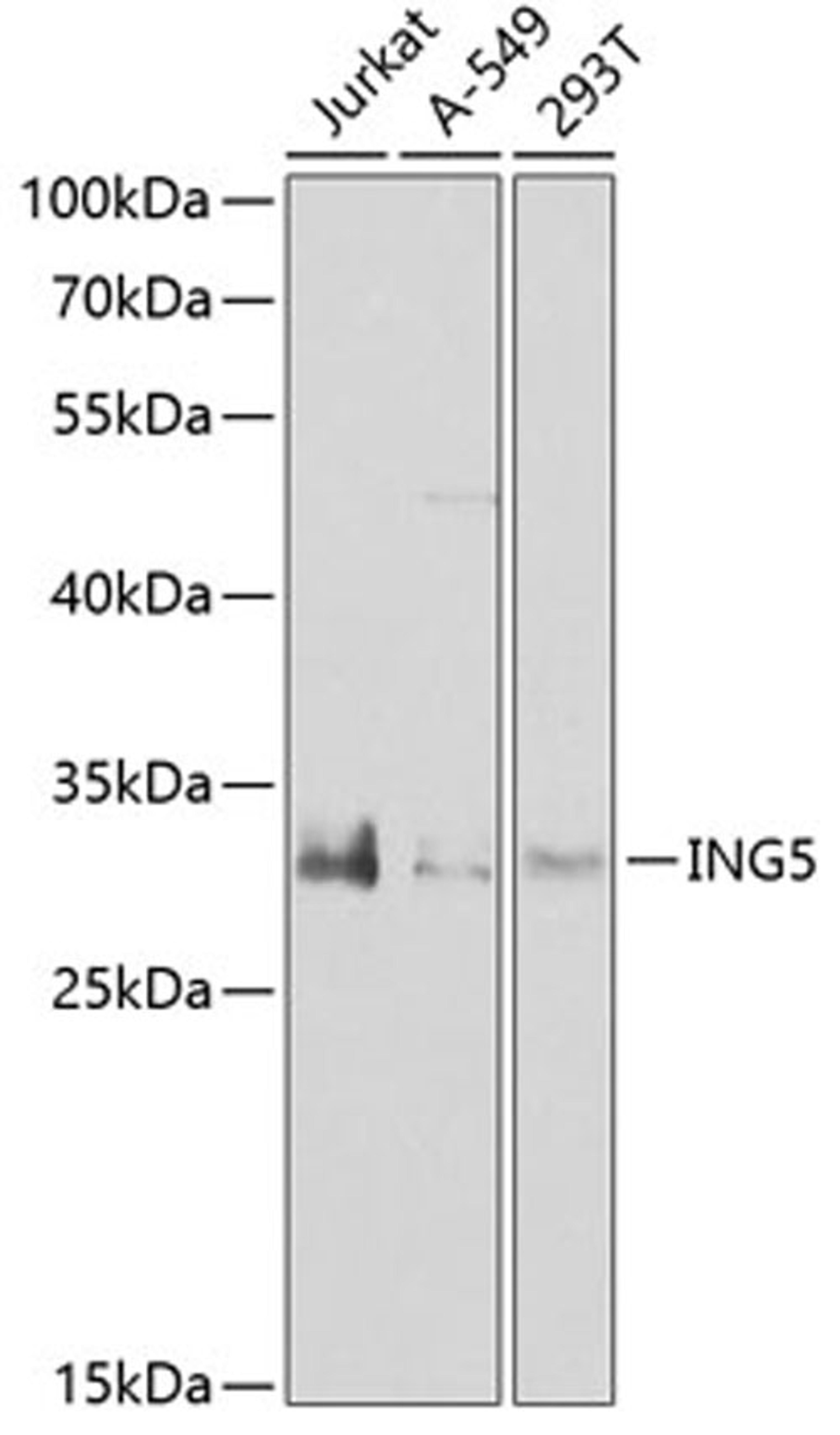 Western blot - ING5 antibody (A7288)