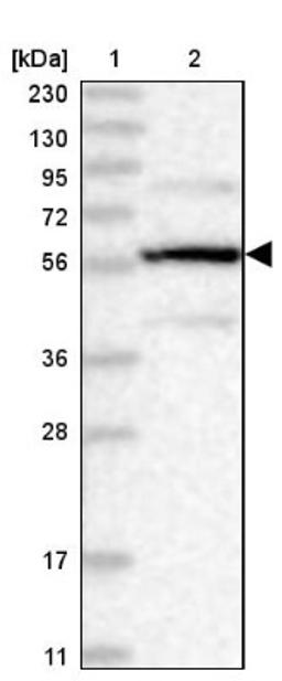 Western Blot: PPP2R5B Antibody [NBP1-88958] - Lane 1: Marker [kDa] 230, 130, 95, 72, 56, 36, 28, 17, 11<br/>Lane 2: Human cell line RT-4