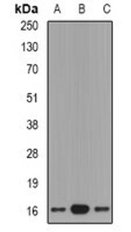 Western blot analysis of mouse lung (Lane1), rat brain (Lane2), rat kidney (Lane3) whole cell lysates using GRP antibody