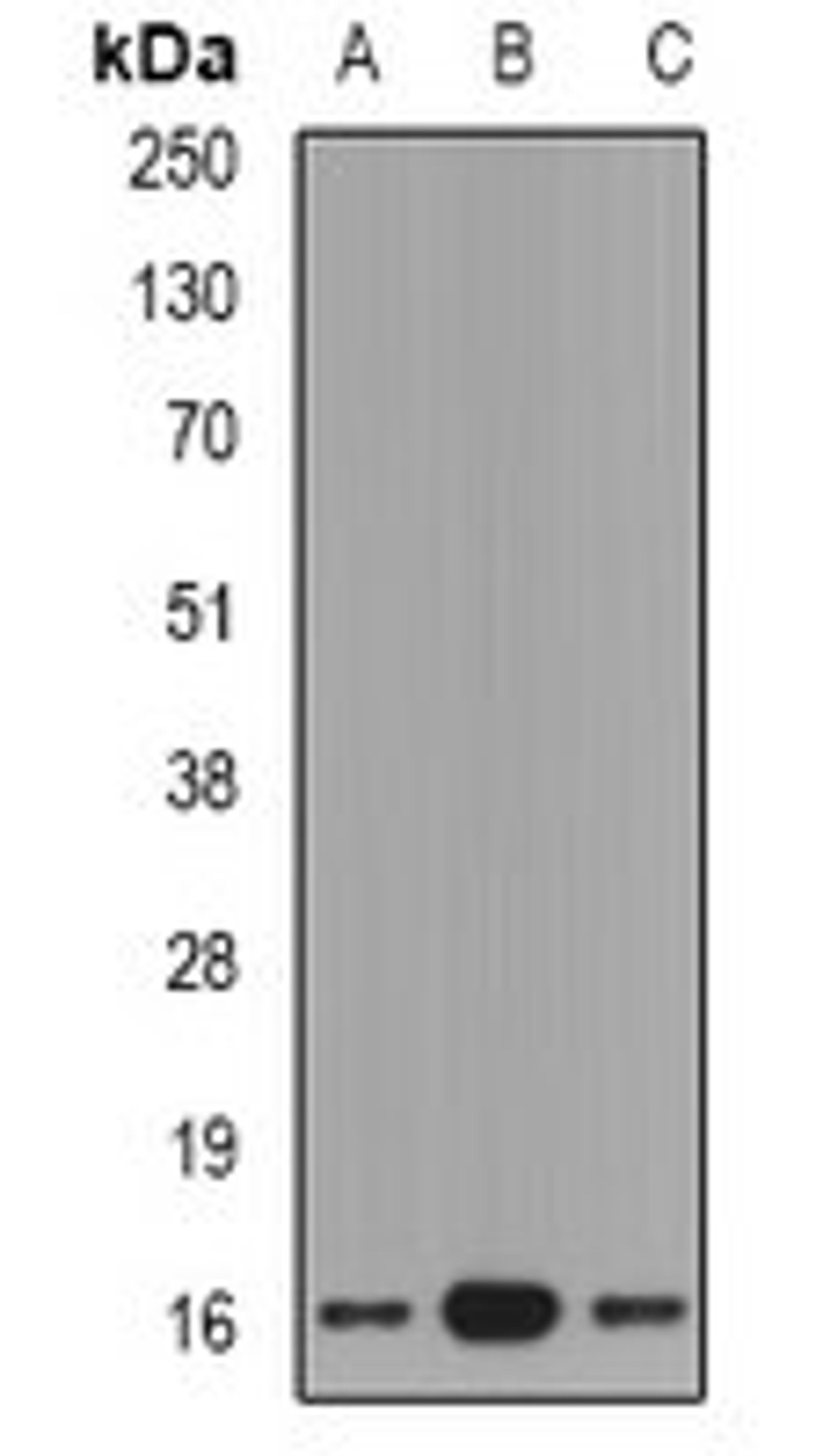 Western blot analysis of mouse lung (Lane1), rat brain (Lane2), rat kidney (Lane3) whole cell lysates using GRP antibody