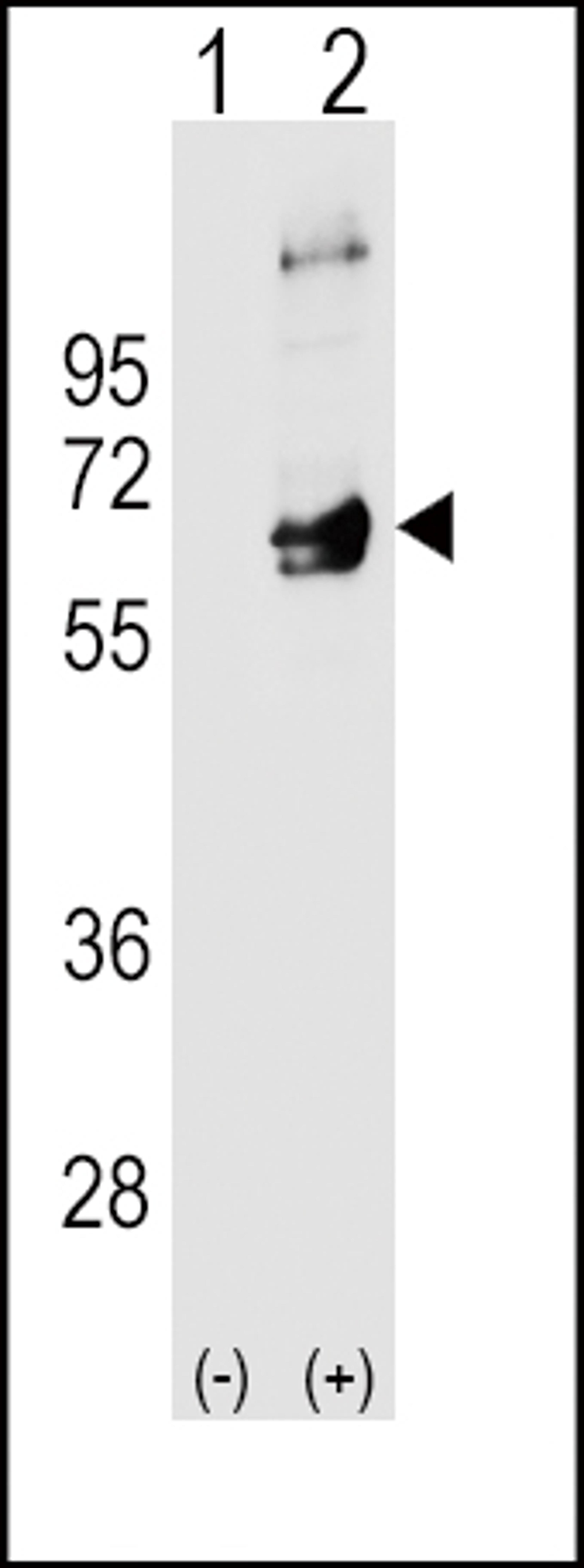 Western blot analysis of FYN using rabbit polyclonal FYN Antibody using 293 cell lysates (2 ug/lane) either nontransfected (Lane 1) or transiently transfected (Lane 2) with the FYN gene.