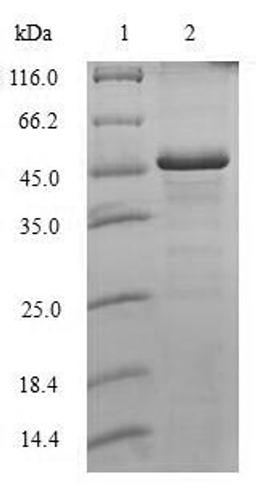 (Tris-Glycine gel) Discontinuous SDS-PAGE (reduced) with 5% enrichment gel and 15% separation gel.
