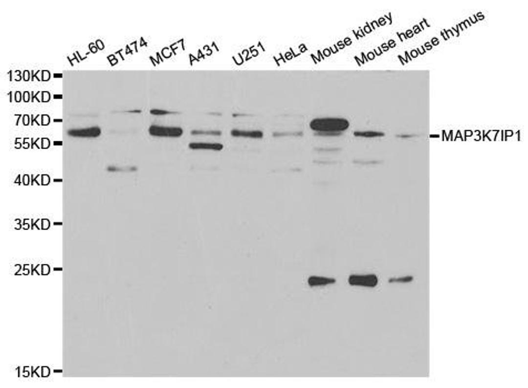 Western blot analysis of extracts of various cell lines using MAP3K7IP1 antibody