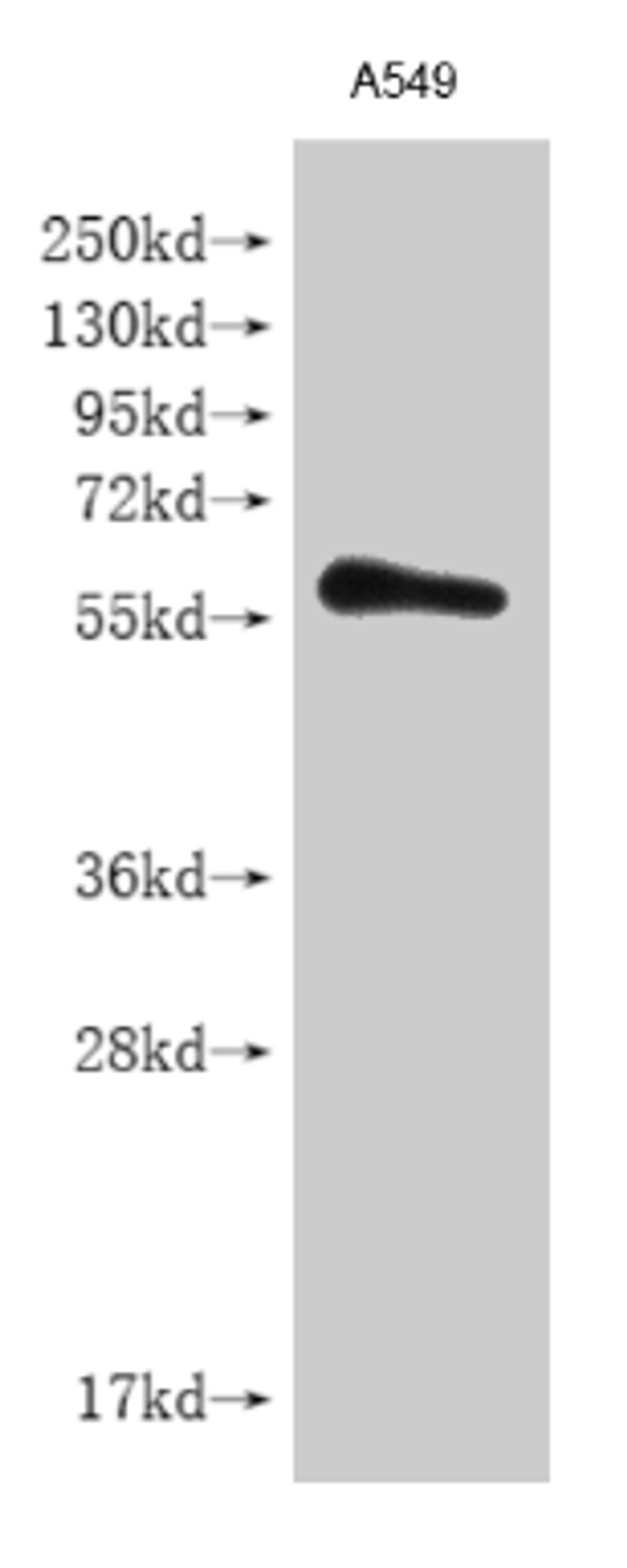 Western blot. All lanes: IFNLR1 antibody at 3.04µg/ml. Lane 1: Mouse kidney tissue. Lane 2: Mouse liver tissue. Lane 3: Human placenta tissue. Lane 4: Mouse lung tissue. Secondary. Goat polyclonal to rabbit IgG at 1/10000 dilution. Predicted band size: 58, 55, 24, 28 kDa. Observed band size: 58 kDa