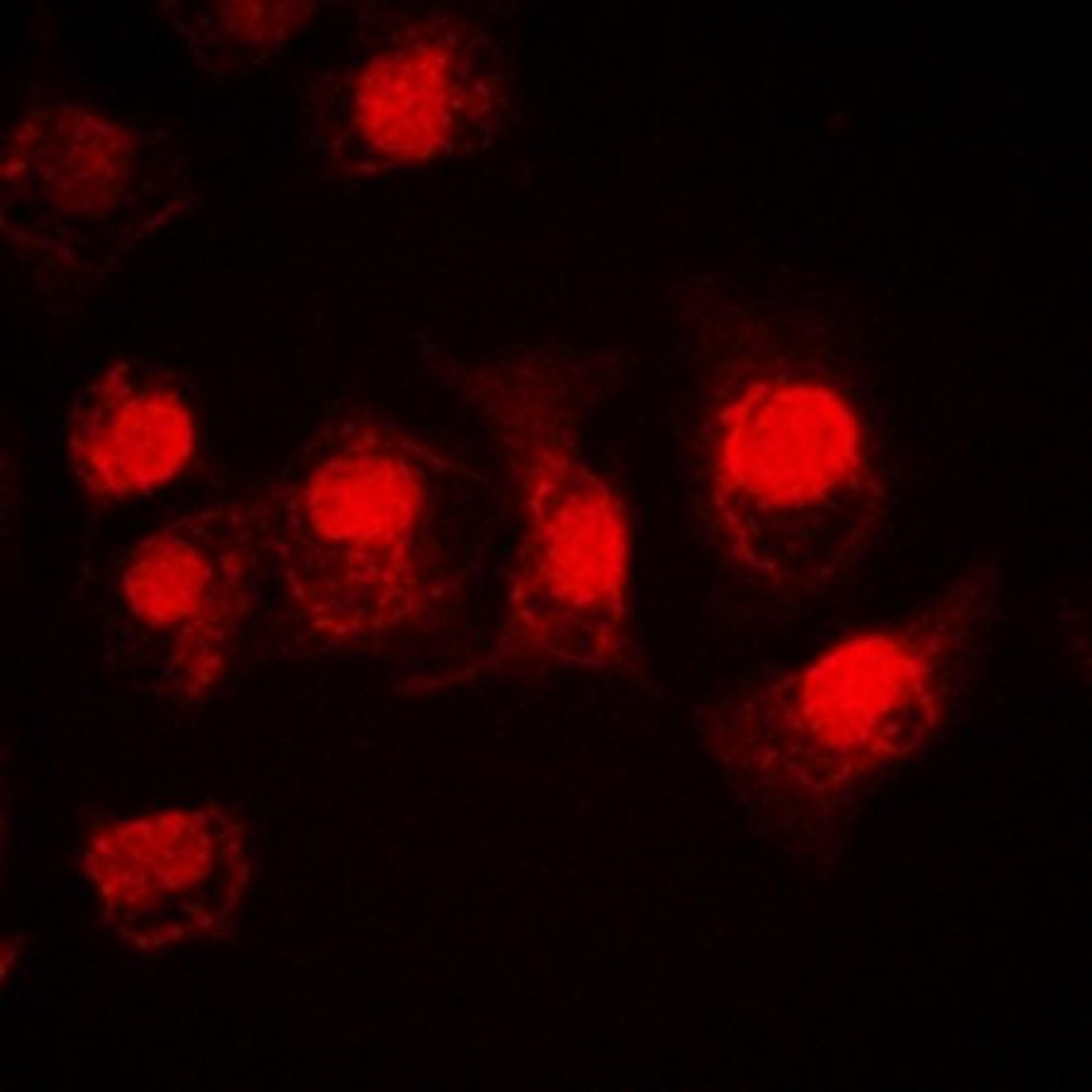 Immunofluorescense analysis of HEK293T cells using MSK1 antibody