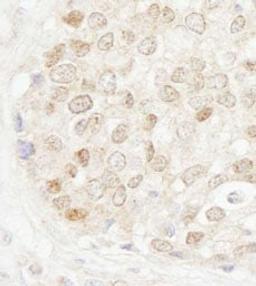 Detection of human MBD4 by immunohistochemistry.