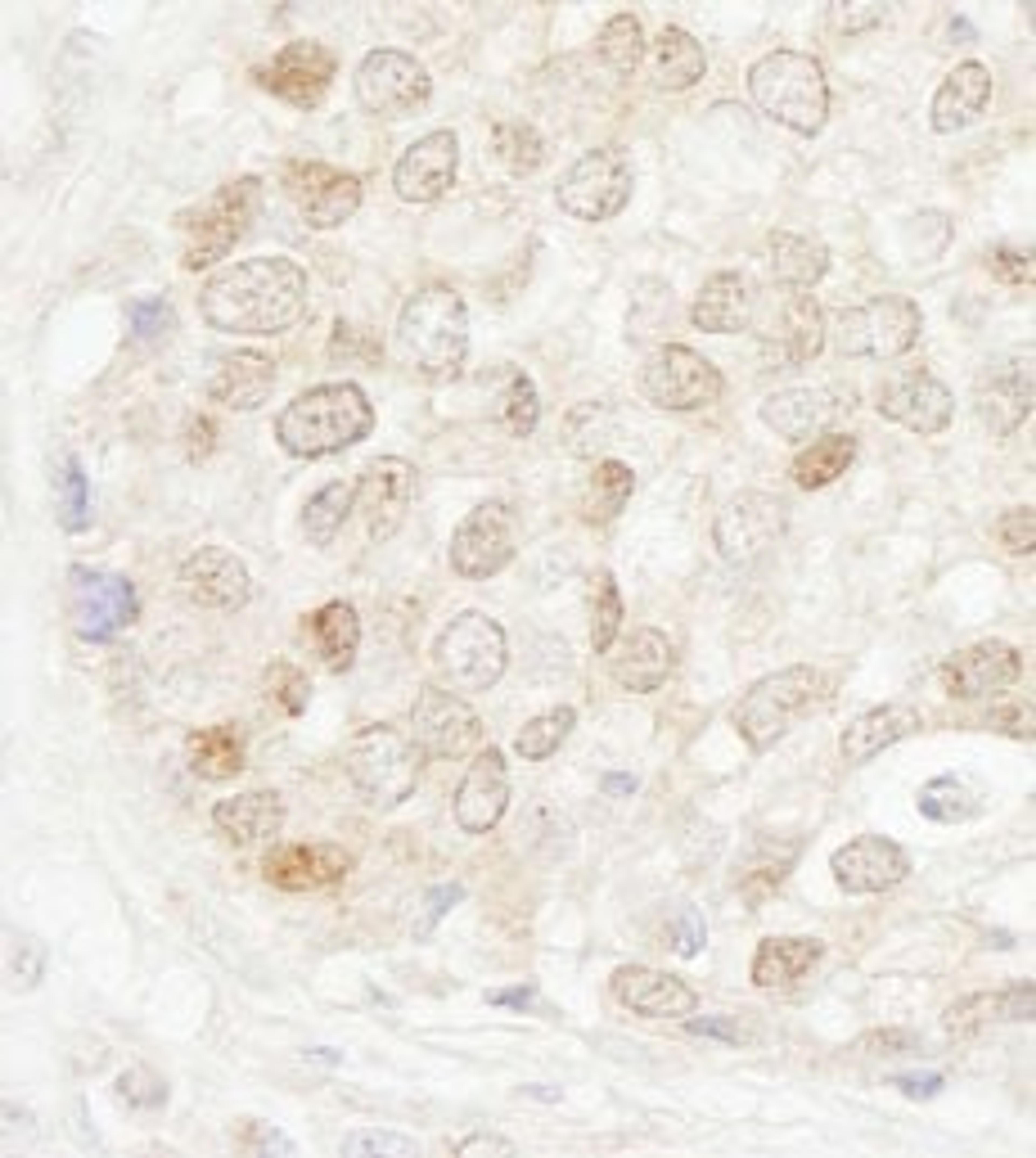 Detection of human MBD4 by immunohistochemistry.