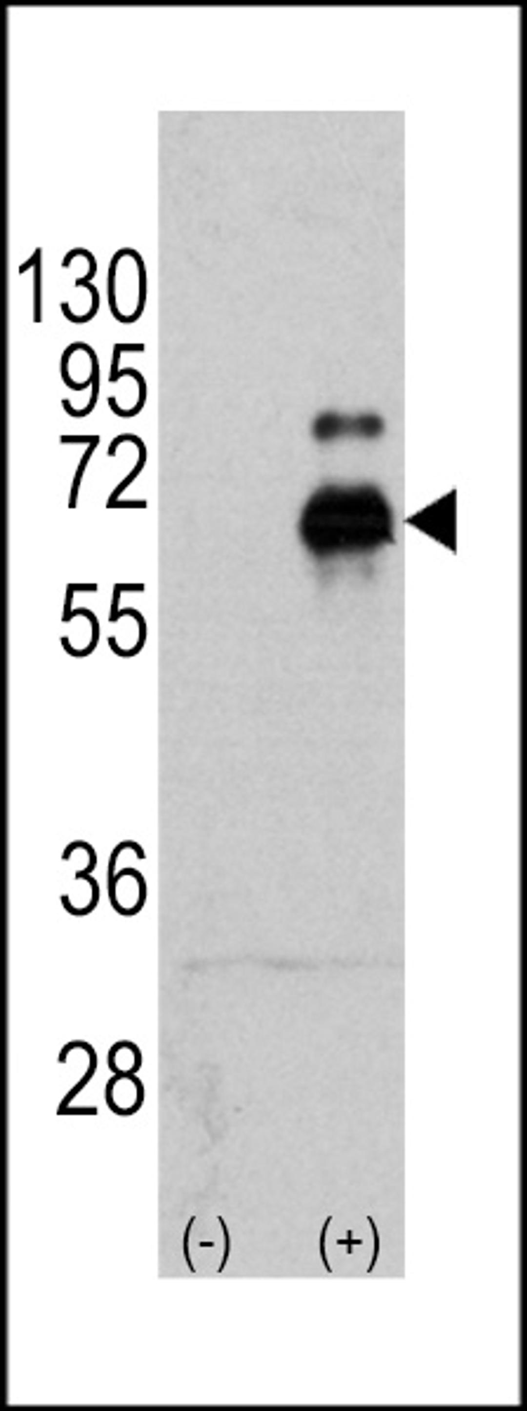 Western blot analysis of RPS6KB1 using rabbit polyclonal RPS6KB1 Antibody (S424) using 293 cell lysates (2 ug/lane) either nontransfected (Lane 1) or transiently transfected with the RPS6KB1 gene (Lane 2). )