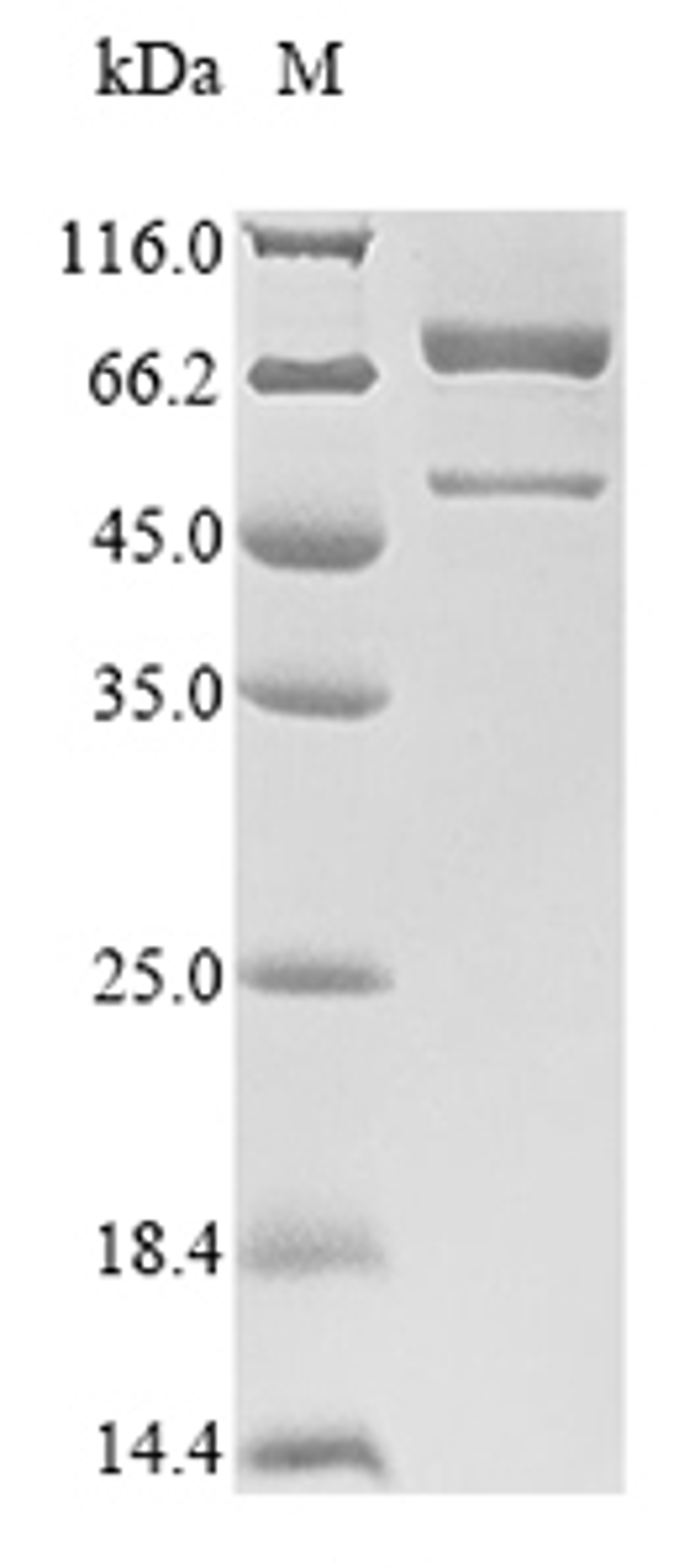 (Tris-Glycine gel) Discontinuous SDS-PAGE (reduced) with 5% enrichment gel and 15% separation gel.