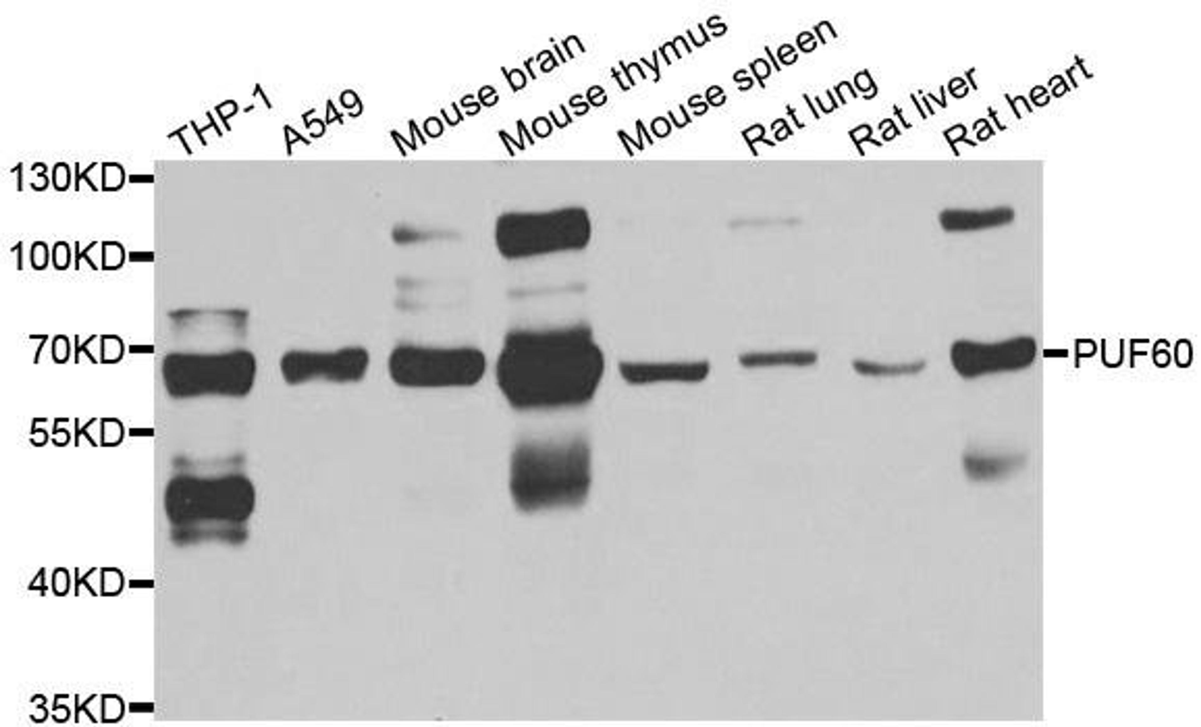 Western blot analysis of extracts of various cell lines using PUF60 antibody