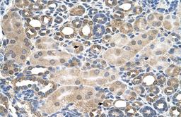 Antibody used in IHC on Human kidney.