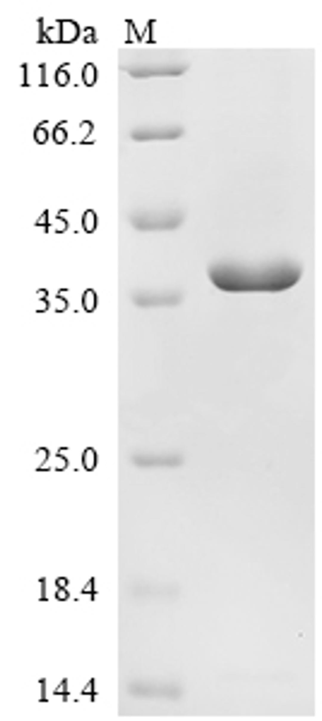 (Tris-Glycine gel) Discontinuous SDS-PAGE (reduced) with 5% enrichment gel and 15% separation gel.