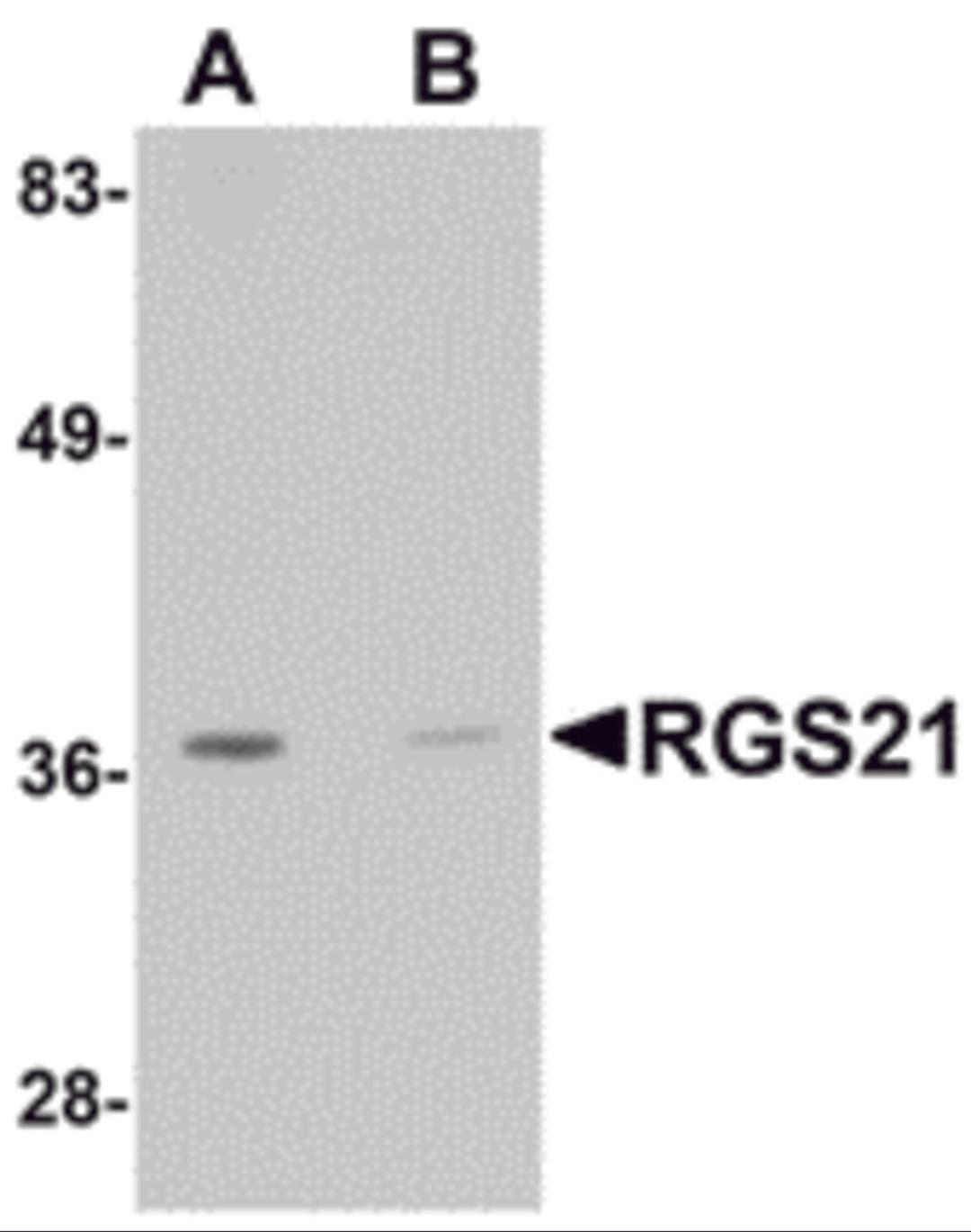 Western blot analysis of RGS21 in HepG2 cell lysate with RGS21 antibody at 0.5 &#956;g/mL in (A) the absence and (B) the presence of blocking peptide.