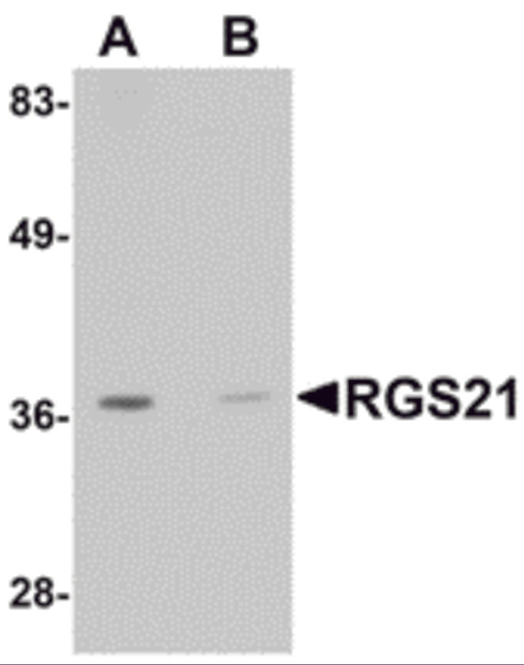 Western blot analysis of RGS21 in HepG2 cell lysate with RGS21 antibody at 0.5 μg/mL in (A) the absence and (B) the presence of blocking peptide.