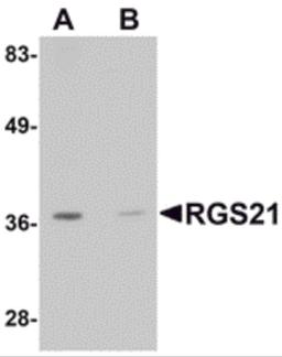 Western blot analysis of RGS21 in HepG2 cell lysate with RGS21 antibody at 0.5 μg/mL in (A) the absence and (B) the presence of blocking peptide.