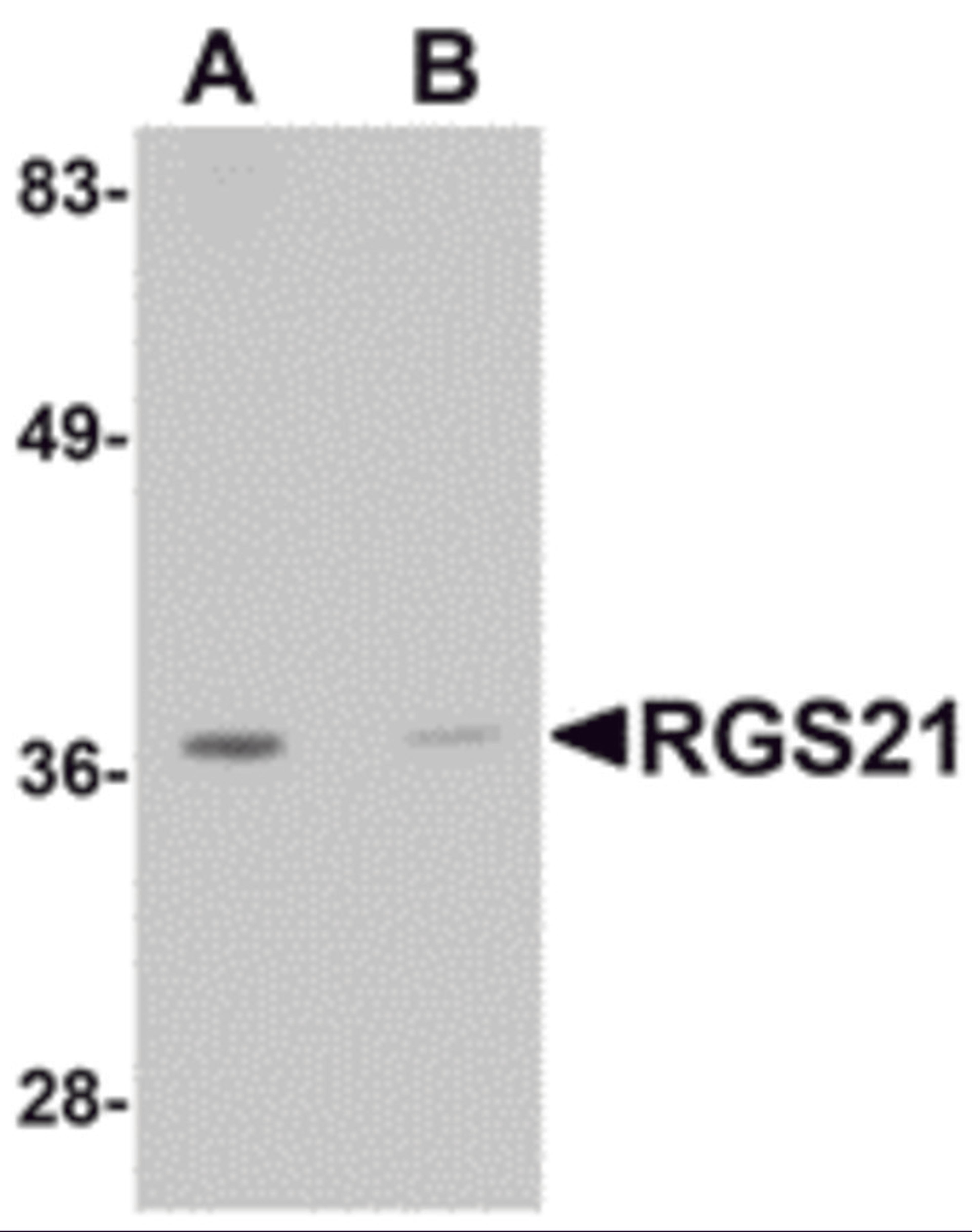 Western blot analysis of RGS21 in HepG2 cell lysate with RGS21 antibody at 0.5 μg/mL in (A) the absence and (B) the presence of blocking peptide.