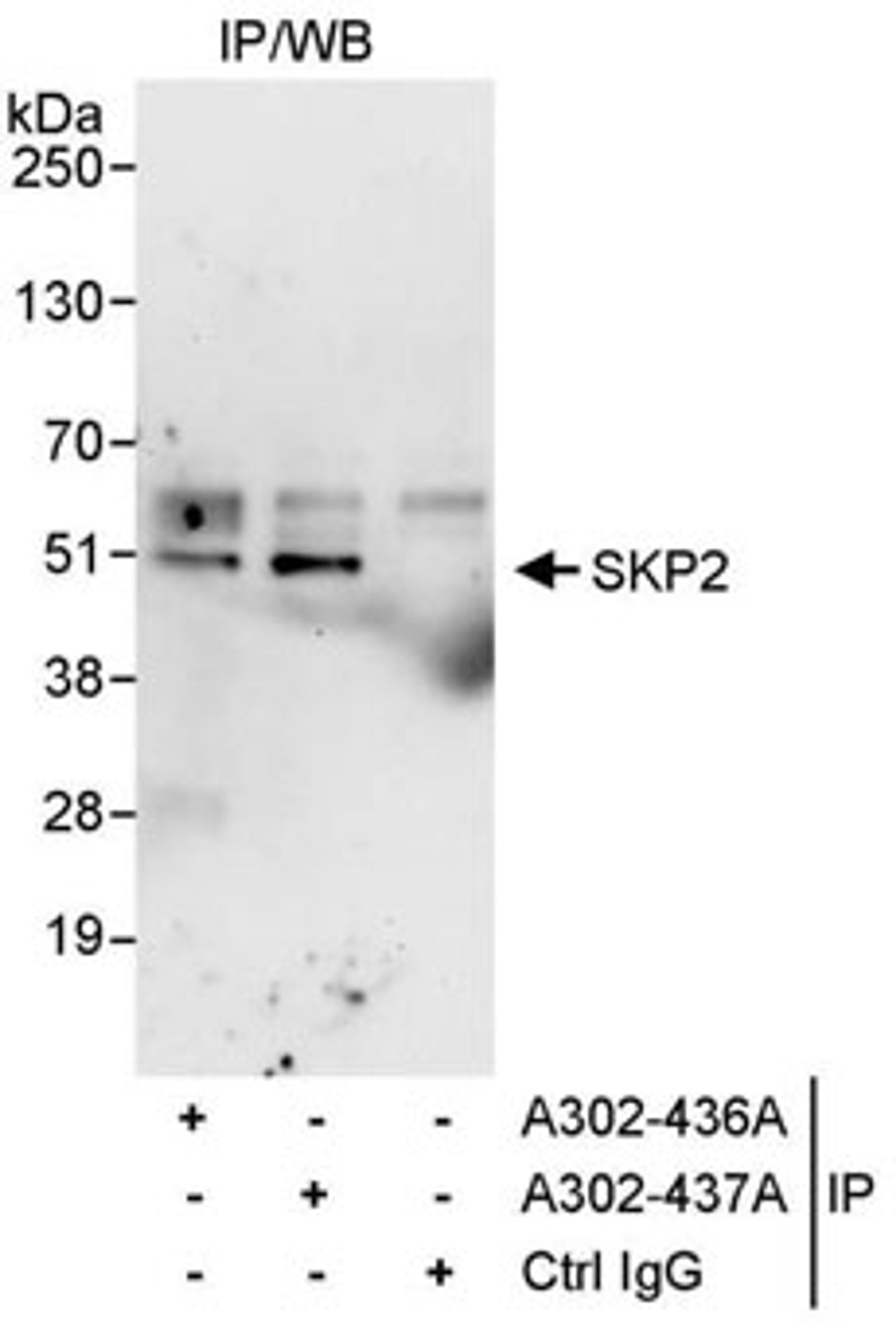 Detection of human SKP2 by western blot of immunoprecipitates.