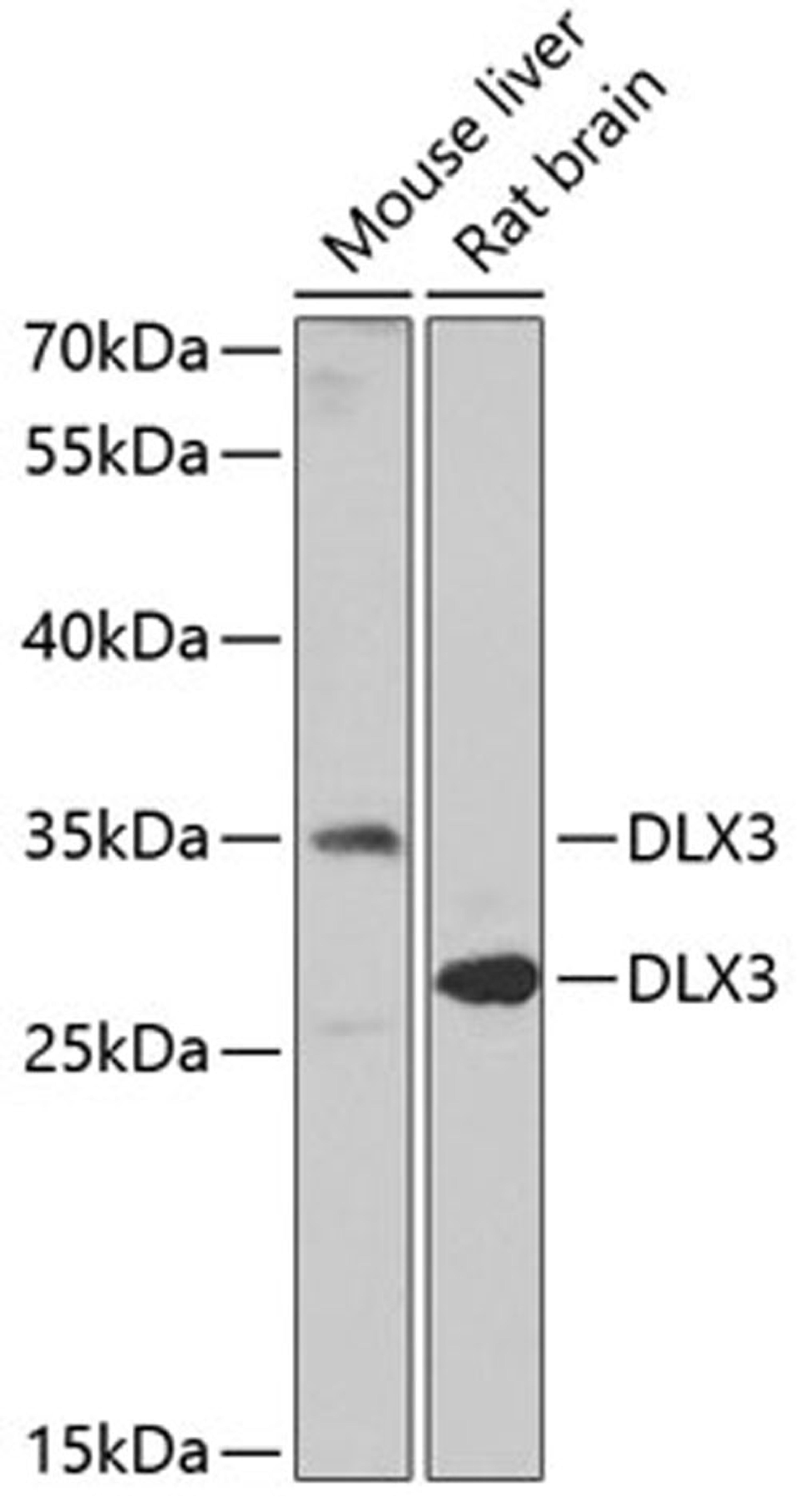 Western blot - DLX3 Antibody (A6902)