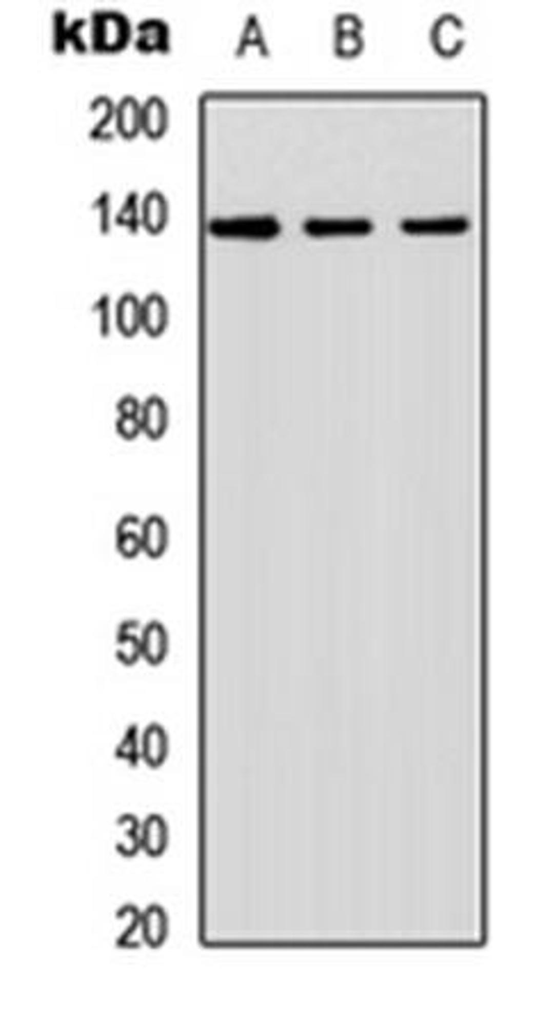 Western blot analysis of A549 (Lane1), NS-1 (Lane2), PC12 (Lane3) whole cell using SHIP2 antibody