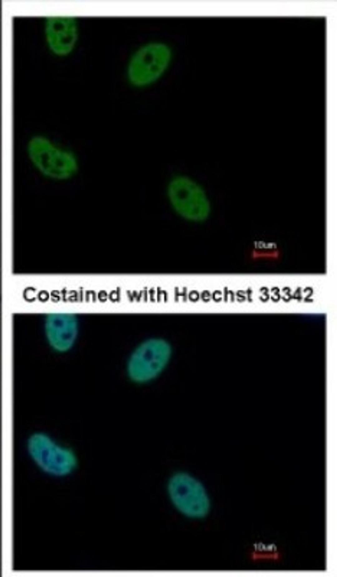 Immunocytochemistry/Immunofluorescence: Rad21 Antibody [NBP2-20053] - Immunofluorescence analysis of paraformaldehyde-fixed HeLa, using antibody at 1:500 dilution.