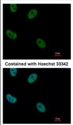 Immunocytochemistry/Immunofluorescence: Rad21 Antibody [NBP2-20053] - Immunofluorescence analysis of paraformaldehyde-fixed HeLa, using antibody at 1:500 dilution.