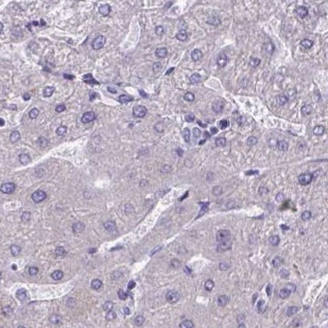 Immunohistochemistry: Desmocollin 3 Antibody [NBP2-31886] - liver