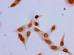 Immunocytochemistry analysis of Hela cells using CSB-PA010378PA16acHU at dilution of 1:100