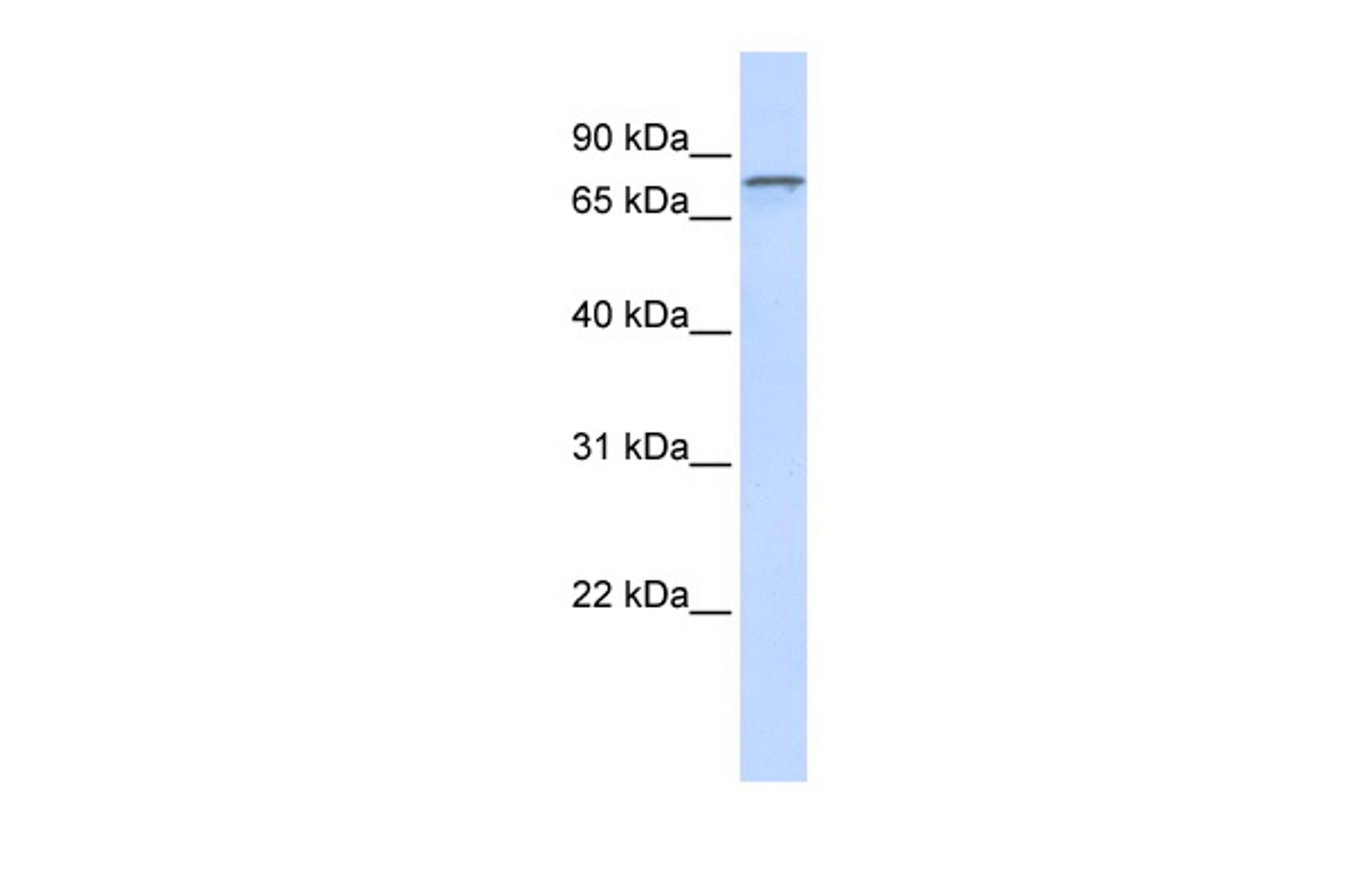 Antibody used in WB on Human brain at 0.2-1 ug/ml.