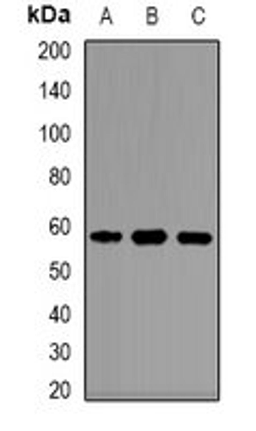 Western blot analysis of Jurkat (Lane1), mouse liver (Lane2), rat liver (Lane3) whole cell lysates using KAT5 antibody