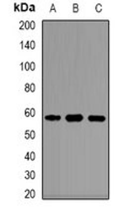 Western blot analysis of Jurkat (Lane1), mouse liver (Lane2), rat liver (Lane3) whole cell lysates using KAT5 antibody