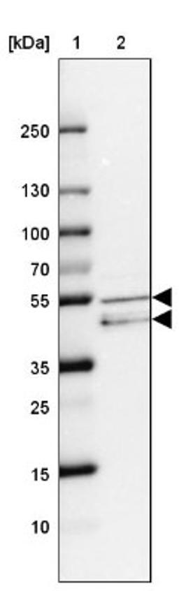 Western Blot: RAR gamma/NR1B3 Antibody [NBP2-47314] - Lane 1: Marker [kDa] 250, 130, 100, 70, 55, 35, 25, 15, 10.  Lane 2: Human cell line MCF-7