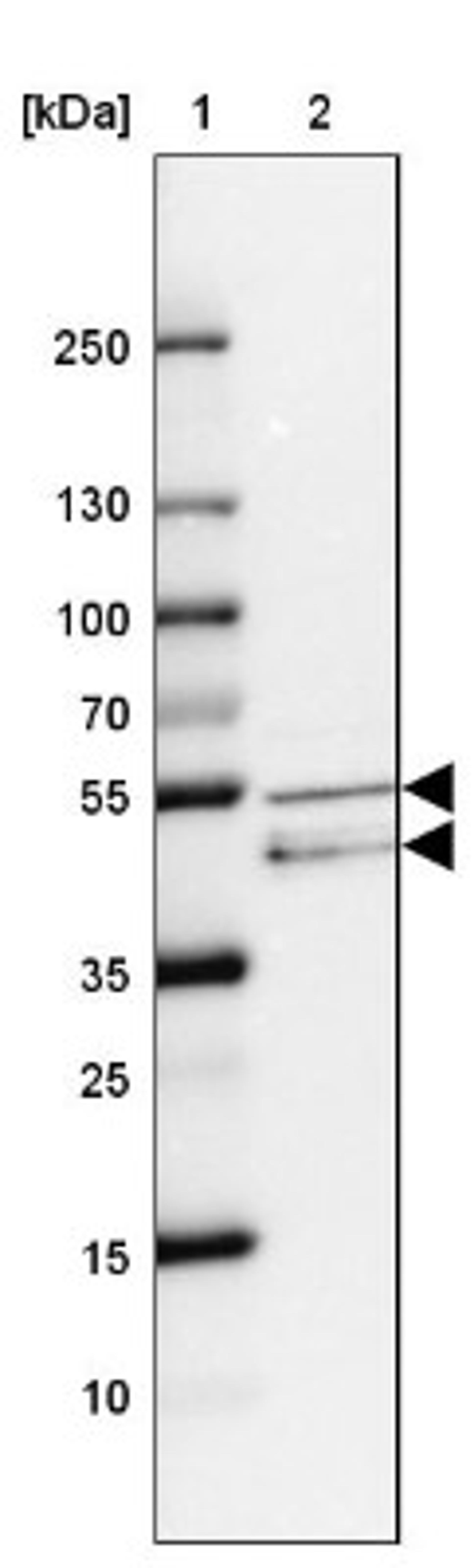 Western Blot: RAR gamma/NR1B3 Antibody [NBP2-47314] - Lane 1: Marker [kDa] 250, 130, 100, 70, 55, 35, 25, 15, 10.  Lane 2: Human cell line MCF-7