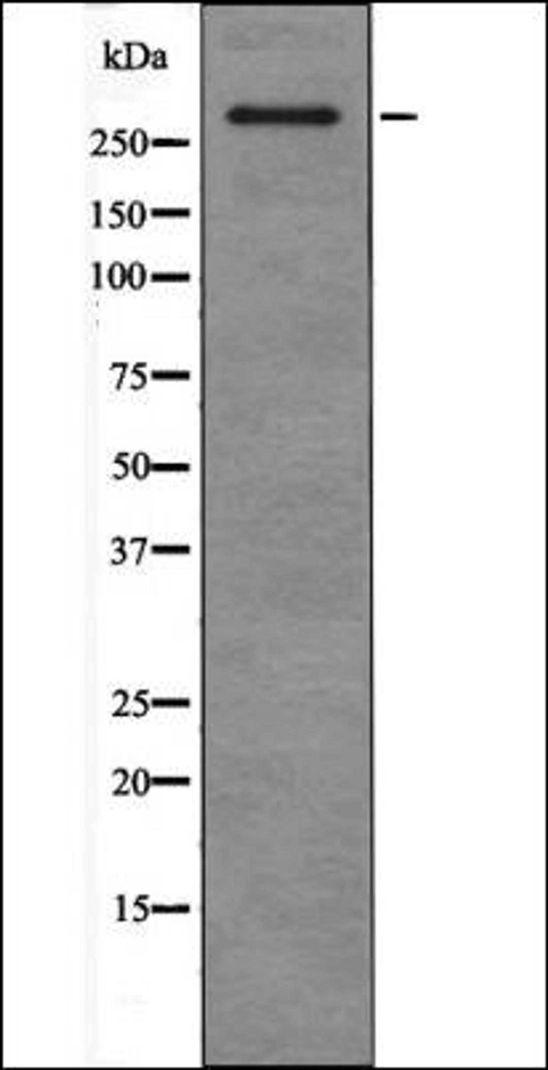 Western blot analysis of HepG2 whole cell lysates using ATM -Phospho-Ser367- antibody