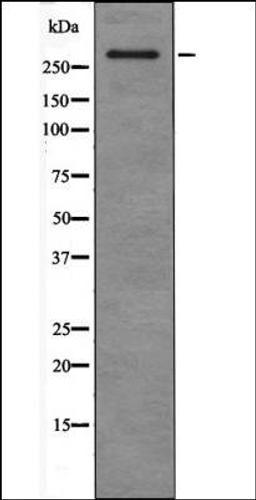 Western blot analysis of HepG2 whole cell lysates using ATM -Phospho-Ser367- antibody