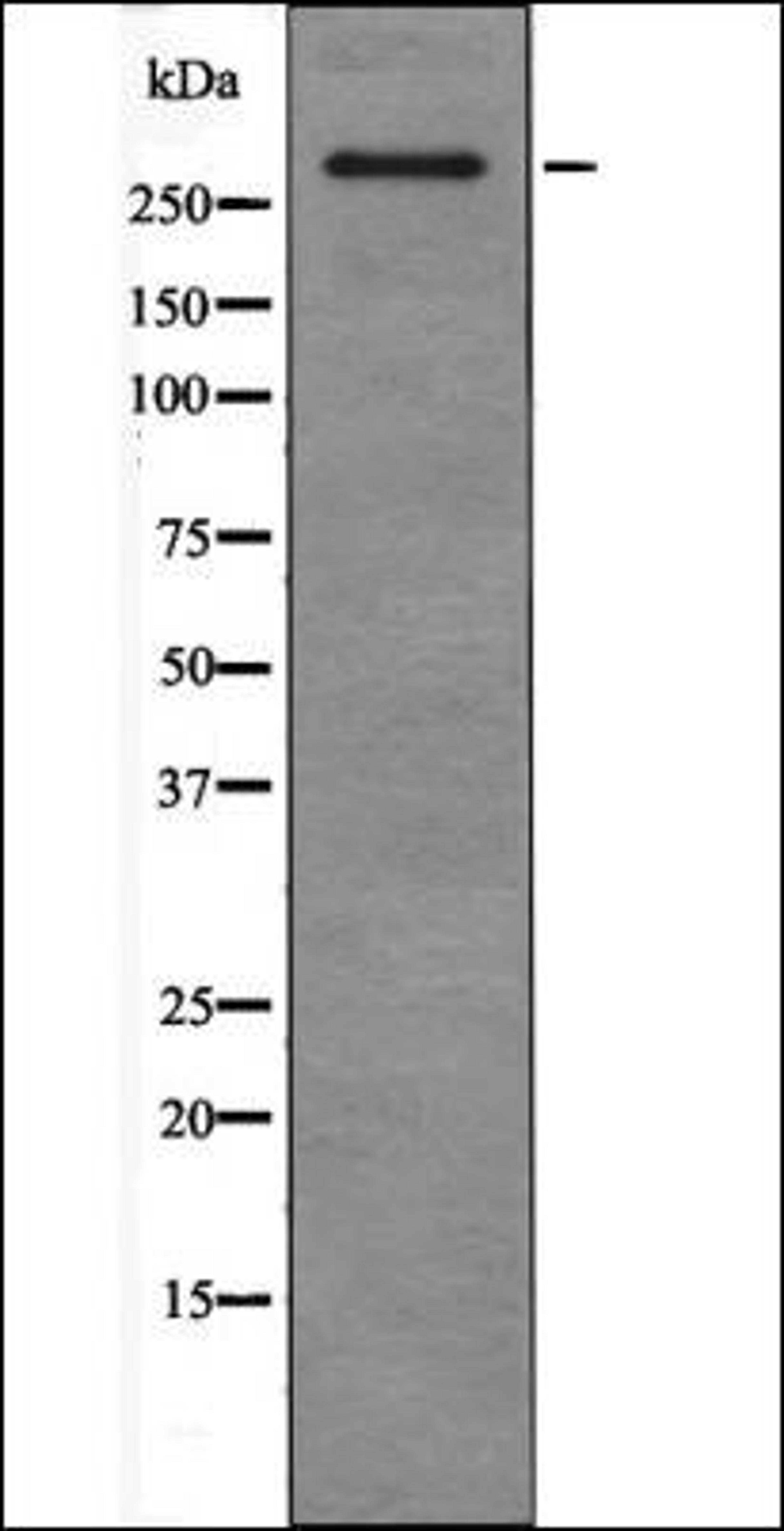 Western blot analysis of HepG2 whole cell lysates using ATM -Phospho-Ser367- antibody