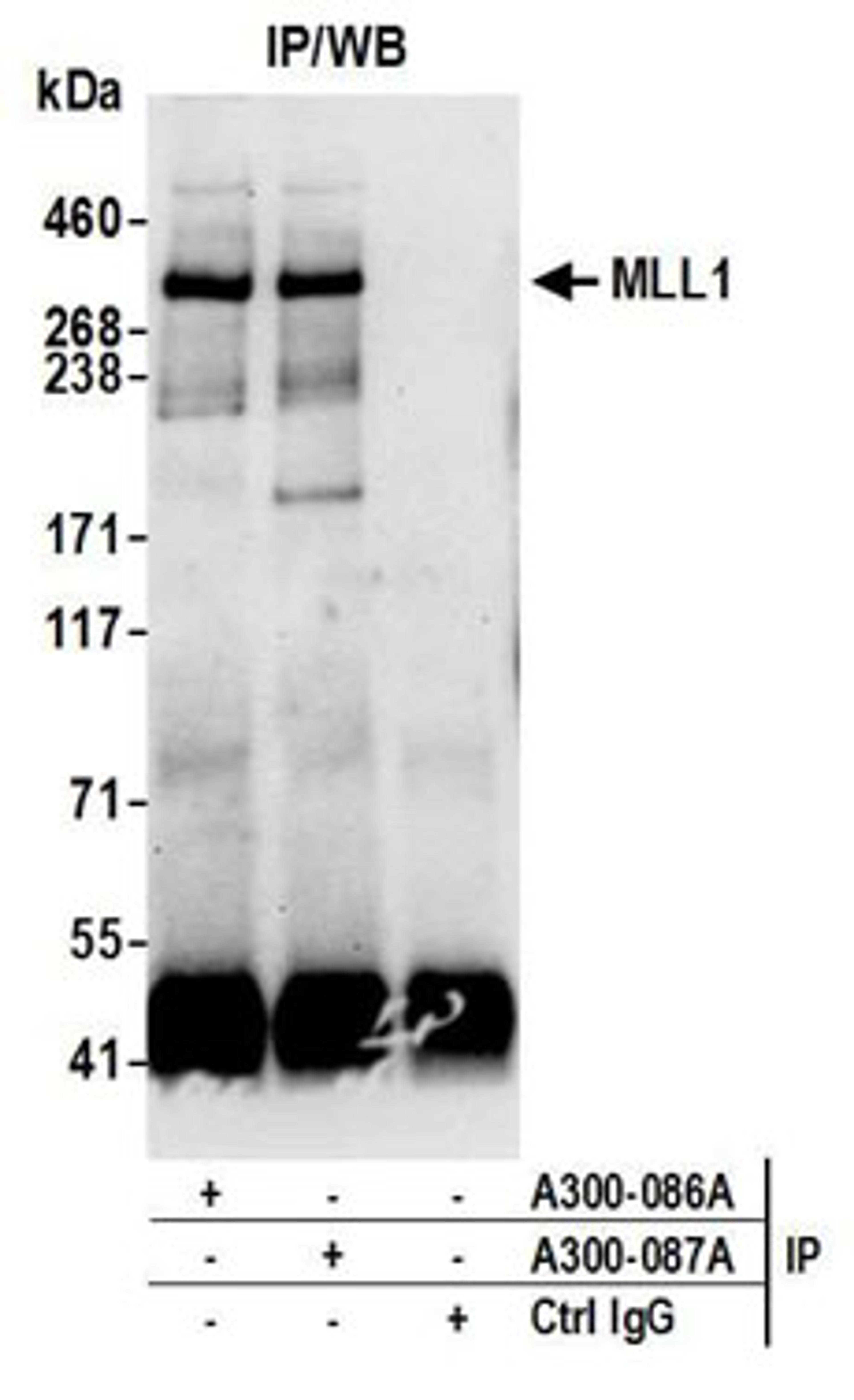 Detection of human MLL1 by western blot of immunoprecipitates.