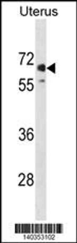 Western blot analysis in human Uterus tissue lysates (35ug/lane).