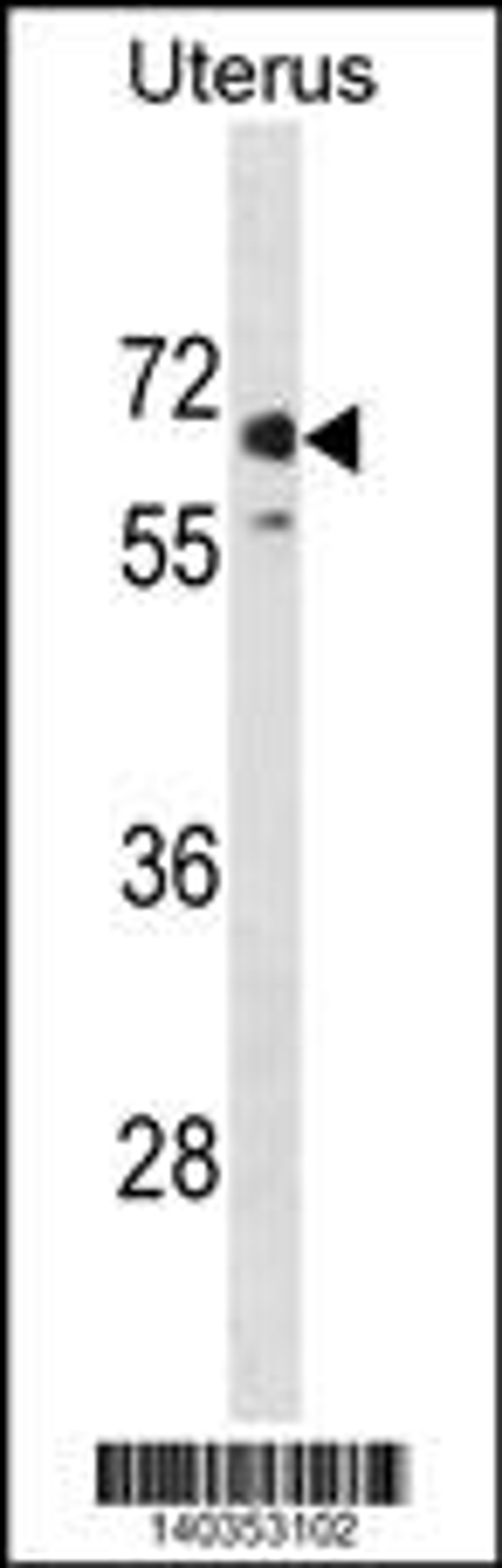 Western blot analysis in human Uterus tissue lysates (35ug/lane).