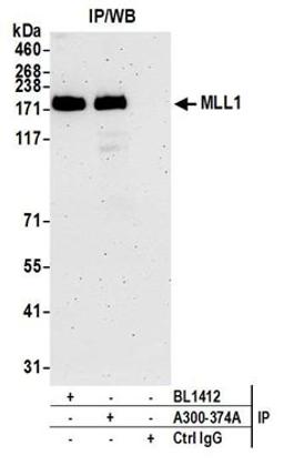 Detection of human MLL1 by western blot of immunoprecipitates.