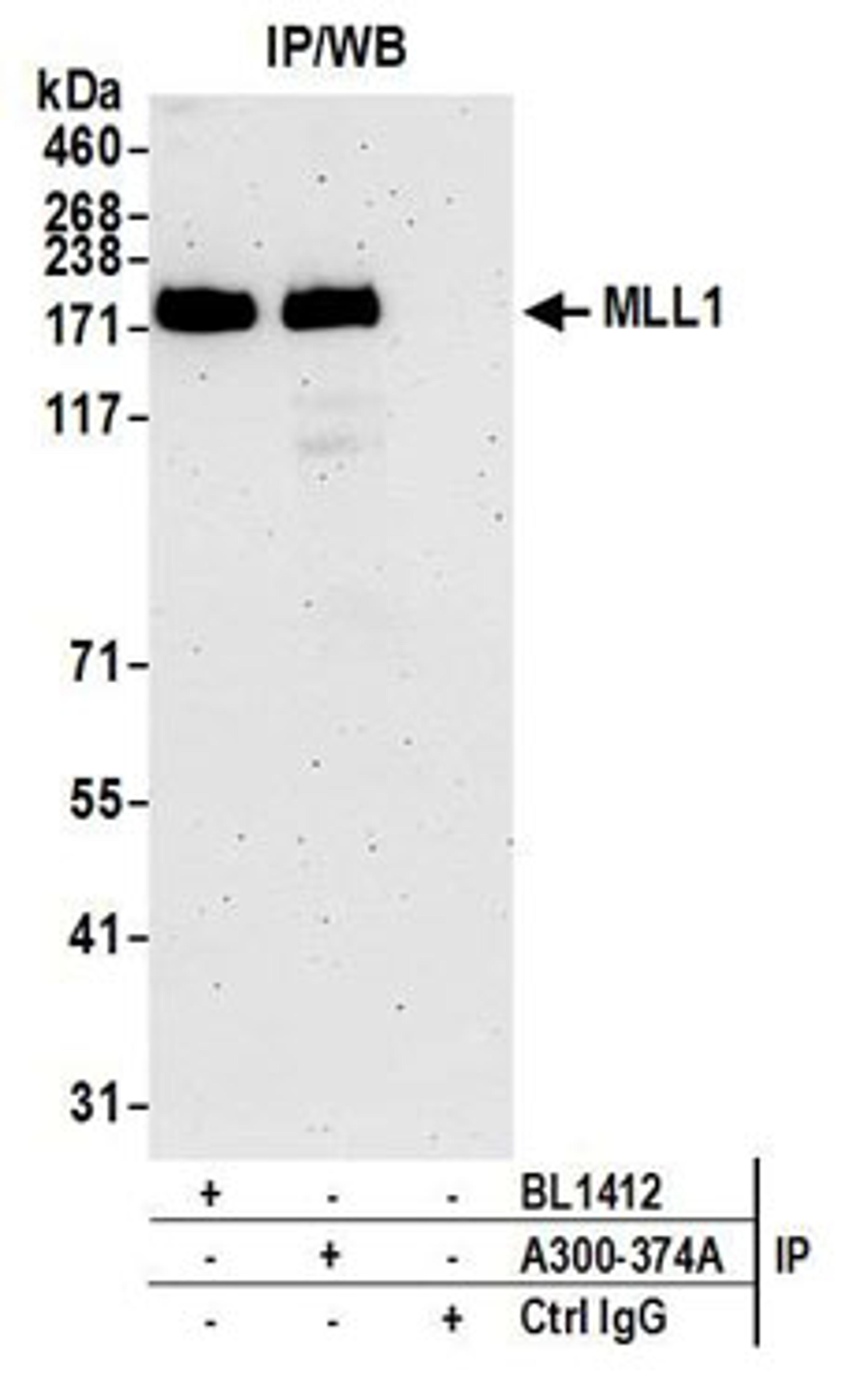 Detection of human MLL1 by western blot of immunoprecipitates.