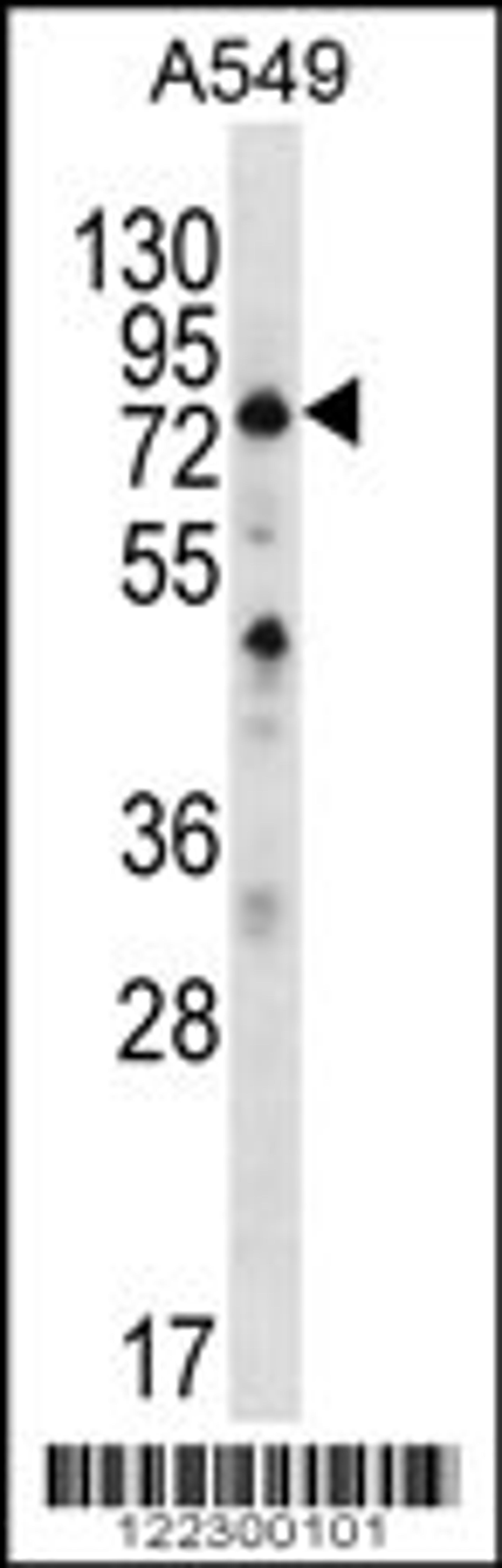 Western blot analysis in A549 cell line lysates (35ug/lane).