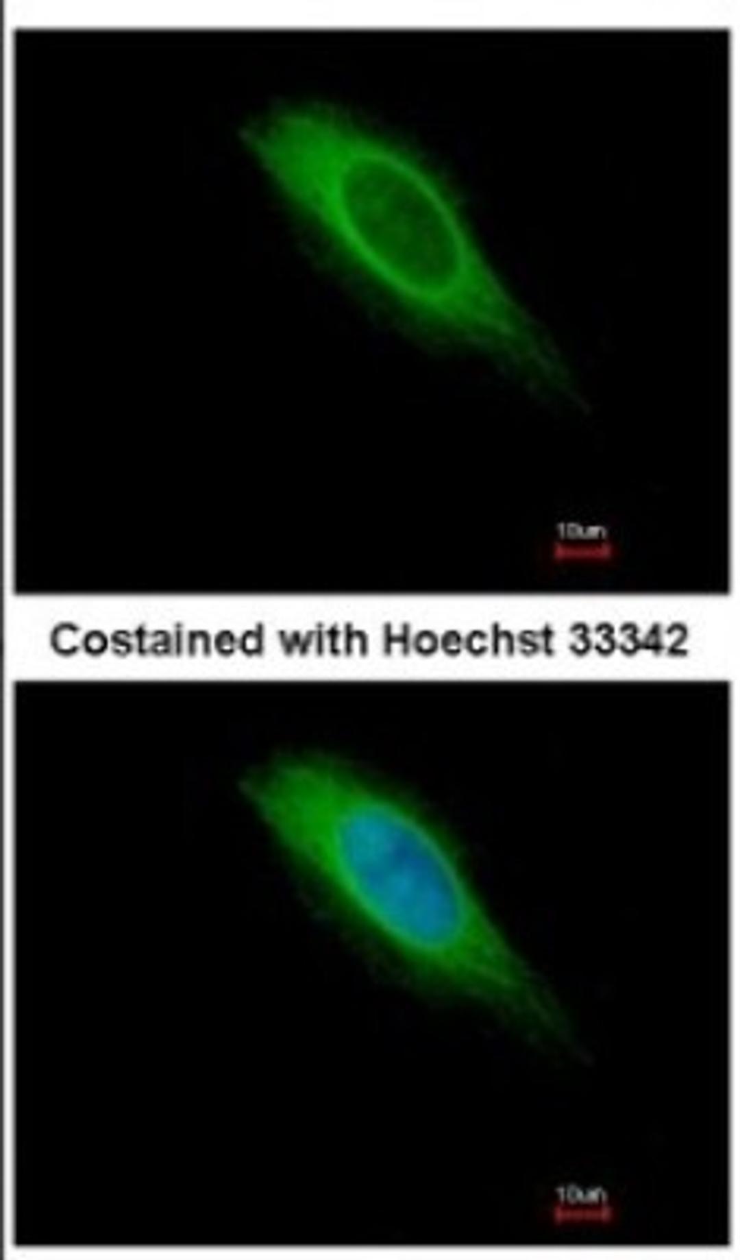 Immunocytochemistry/Immunofluorescence: HMGCS1 Antibody [NBP2-16861] - Immunofluorescence analysis of methanol-fixed HeLa, using antibody at 1:500 dilution.