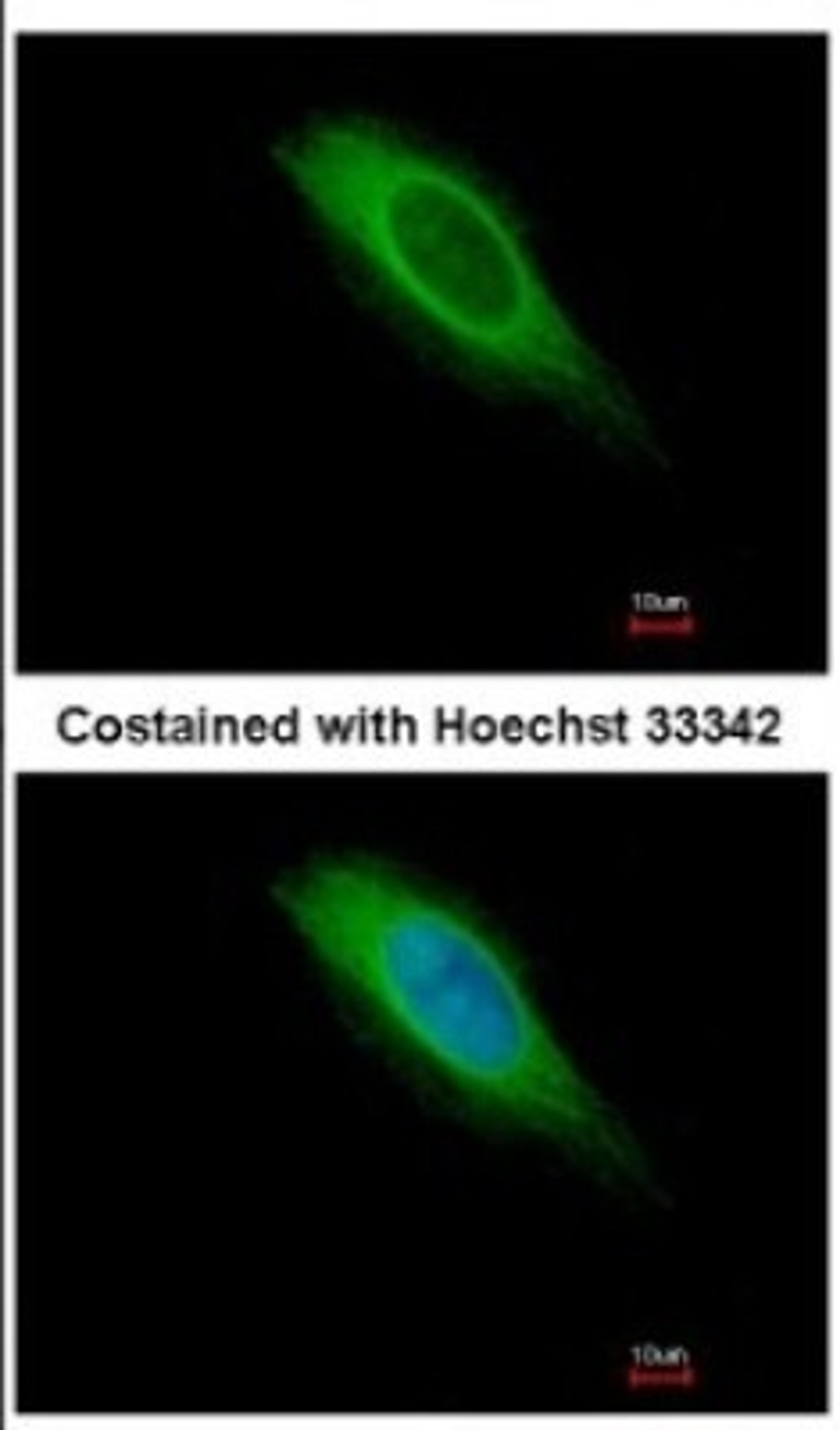 Immunocytochemistry/Immunofluorescence: HMGCS1 Antibody [NBP2-16861] - Immunofluorescence analysis of methanol-fixed HeLa, using antibody at 1:500 dilution.