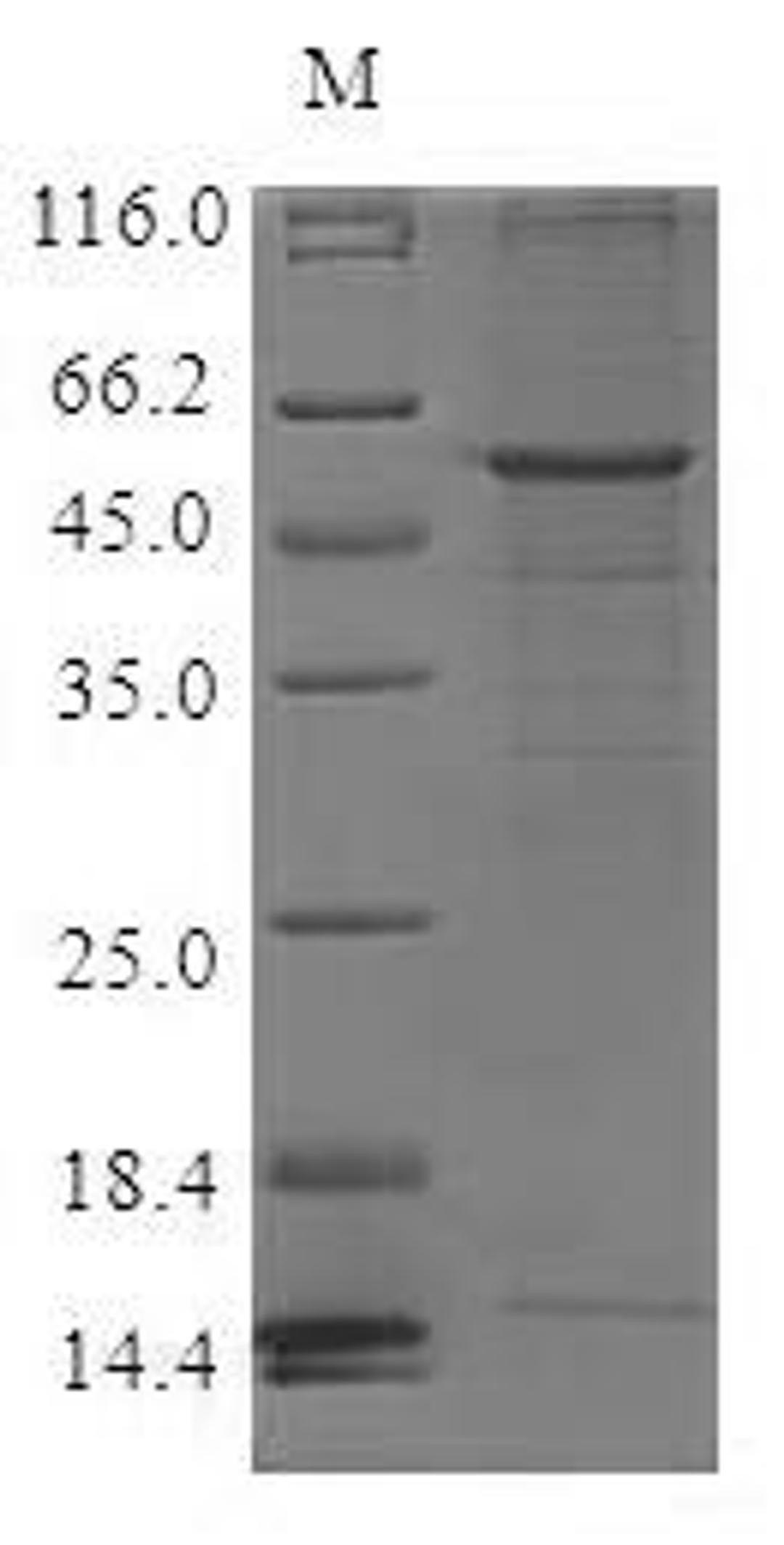 (Tris-Glycine gel) Discontinuous SDS-PAGE (reduced) with 5% enrichment gel and 15% separation gel.