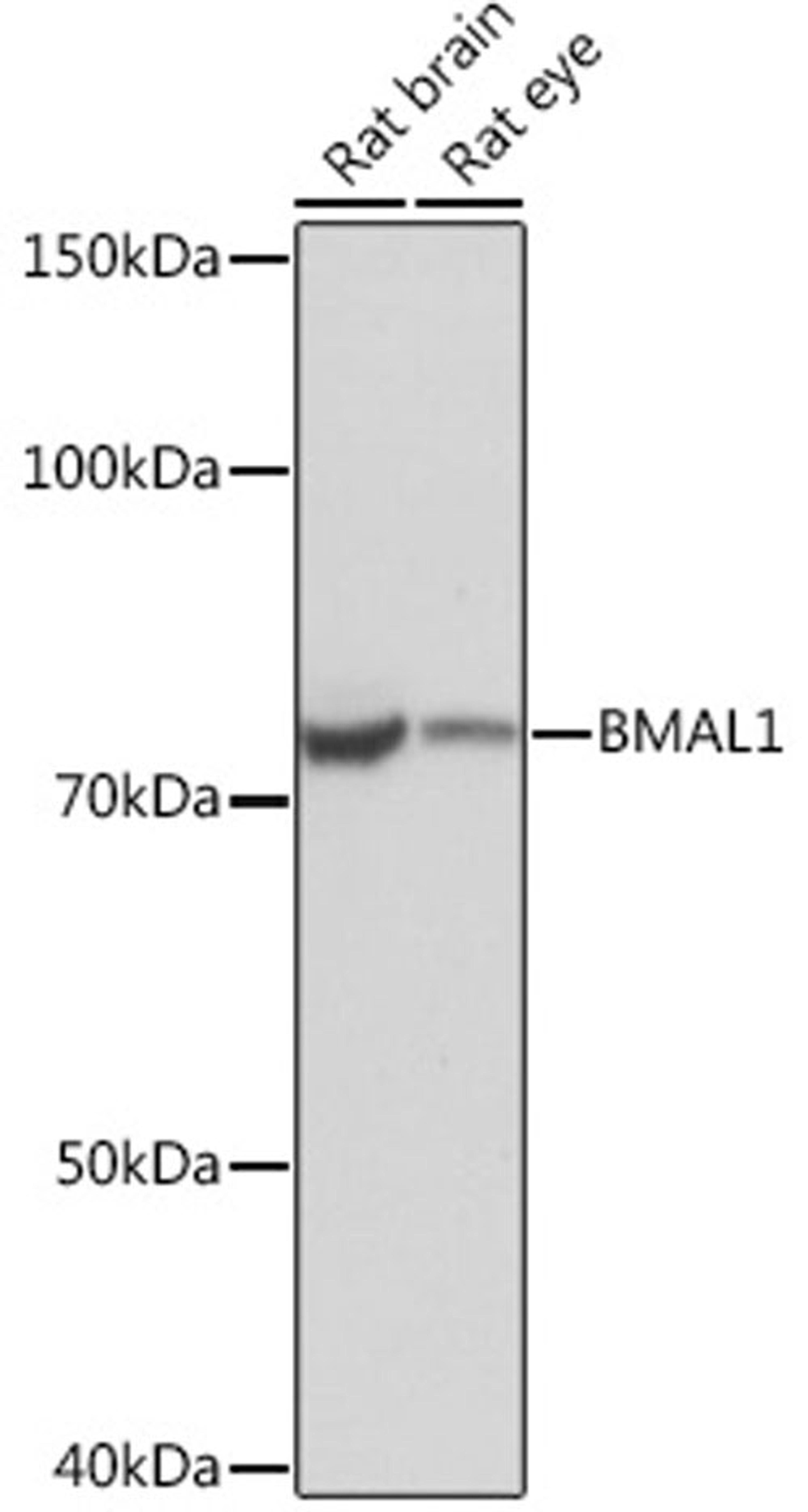 Western blot - BMAL1 Rabbit mAb (A4714)