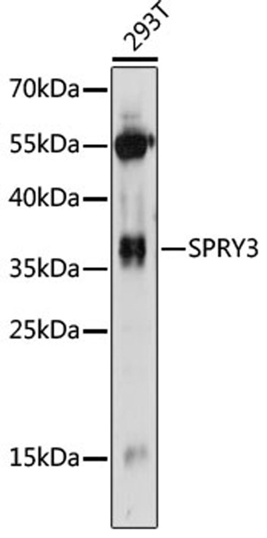 Western blot - SPRY3 antibody (A14669)