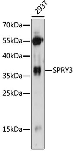 Western blot - SPRY3 antibody (A14669)